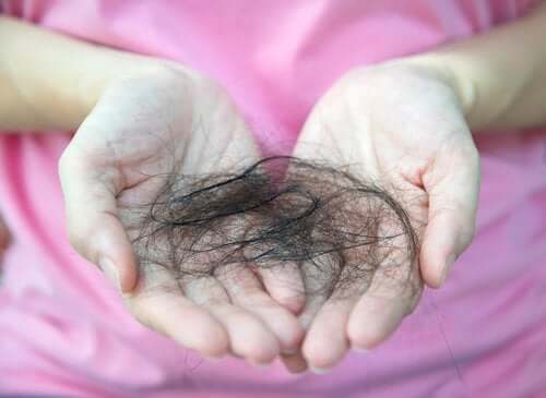 Wat weet je over alopecia na de bevalling?