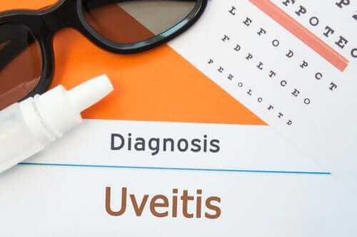Wat zijn de symptomen van een uveïtis?