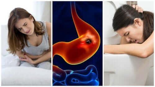 Vrouw met klachten van een maagzweer