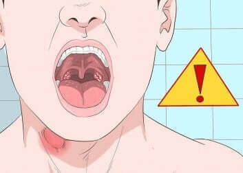 Wat kun je tegen aften in je keel doen