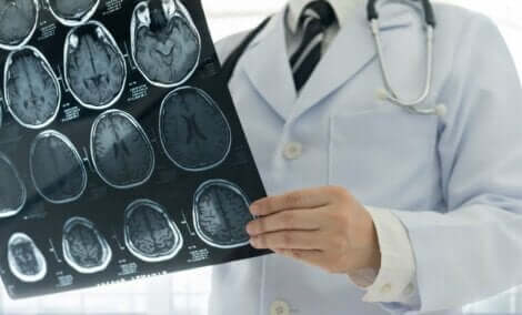 Een arts met een röntgenfoto van hersenen 