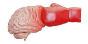 Wat is traumatisch hersenletsel precies?