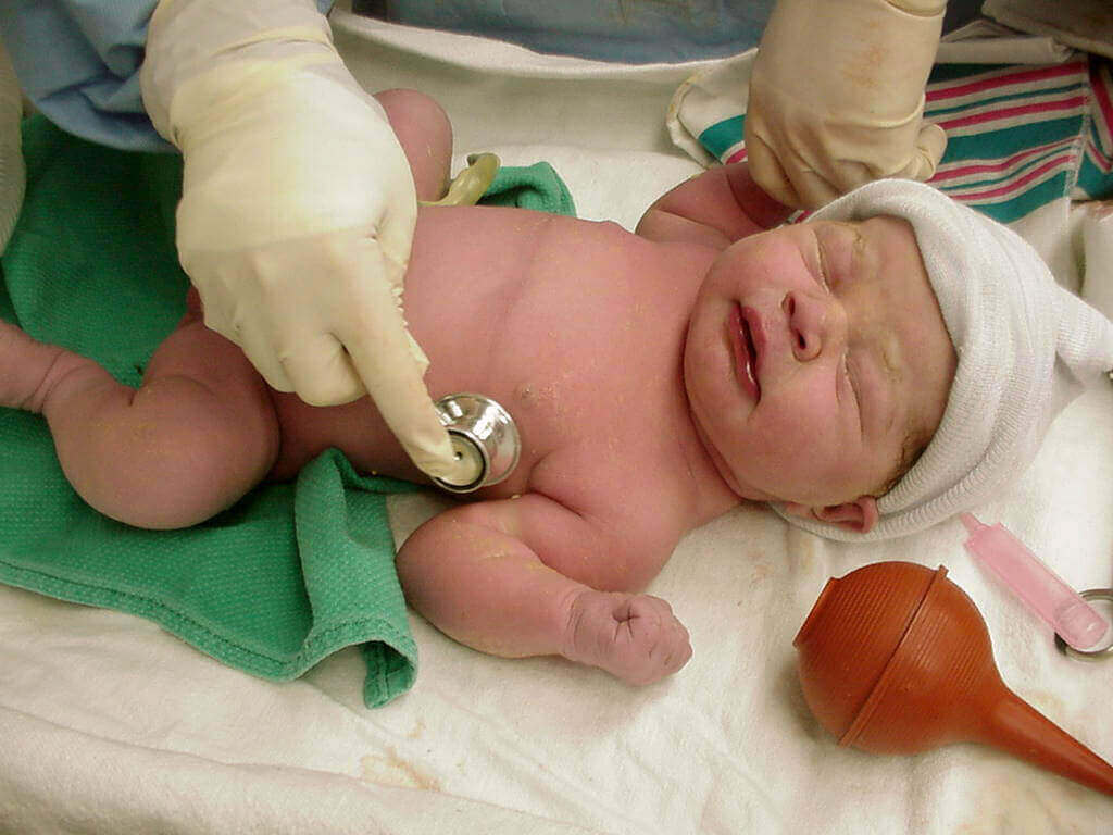 Het neonataal onthoudingssyndroom