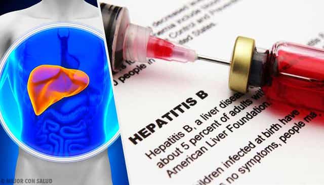 Wat zijn de symptomen van hepatitis