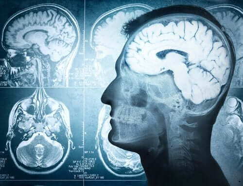 Delen van de hersenen en hun functies