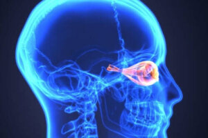 Wat is neuromyelitis optica of de ziekte van Devic?