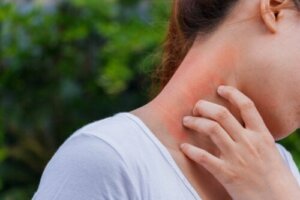 De link tussen dermatitis en corticosteroïden