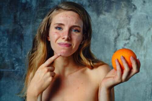 Behandeling en symptomen van een citrusallergie