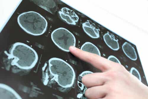 De verschillen tussen een CT-scan en een MRI