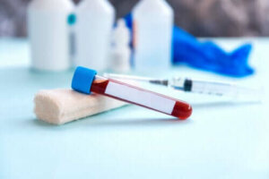 Erytrocytbezinkingssnelheid: de procedure
