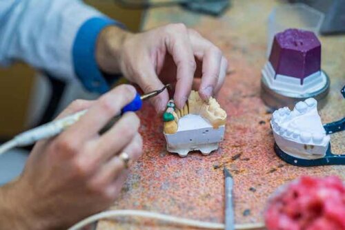 Een orthodontist maakt een brug voor een gebit