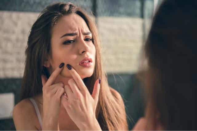 Isotretinoïne voor acne