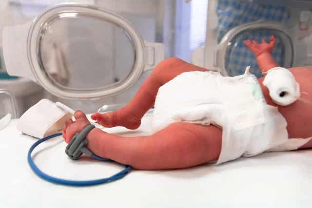 Een premature baby