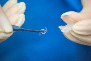 Wanneer is een intraoculaire lensoperatie nodig?