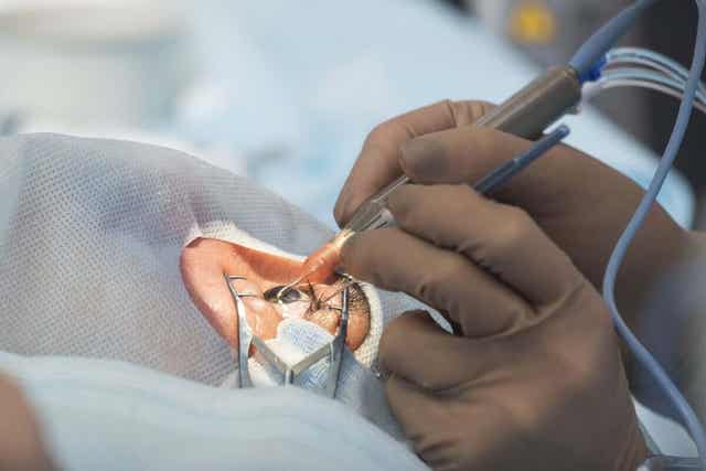 Arts voert een operatie uit