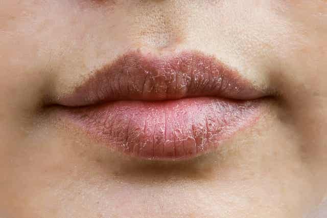 Lanoline gebruiken bij droge lippen