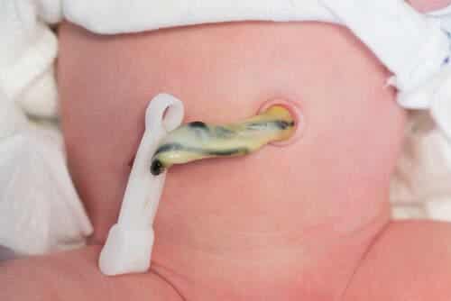Hoe zorg je voor de navel van je baby