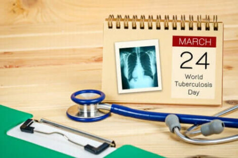 Wereldtuberculosedag: maak een einde aan tuberculose