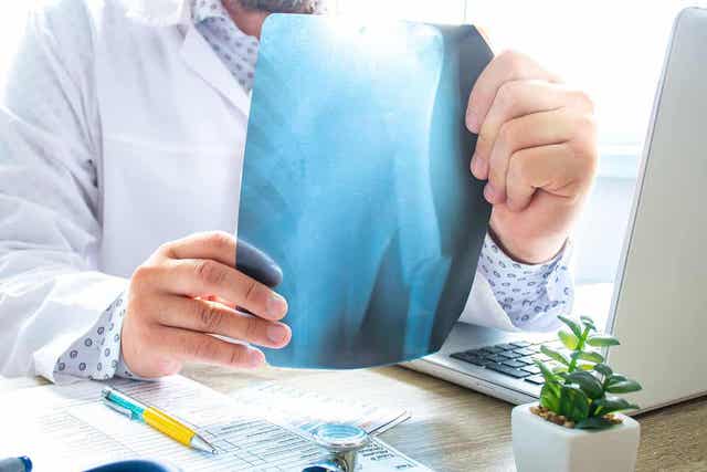 Röntgenfoto van een gebroken arm