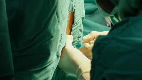 Iemand ondergaat een lumbaalpunctie