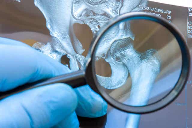 Ben jij een grote LEUGENAAR? Raak de tong aan!ergrootglas boven een heupgewricht