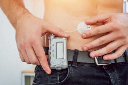 Wat zijn insulinepompen? Ontdek het hier