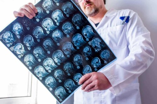 Arts die CT-scan bekijkt