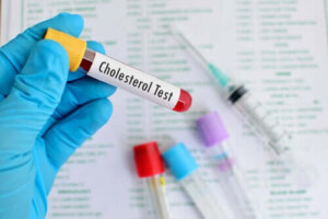 HDL- en LDL-cholesterol: alles wat je moet weten