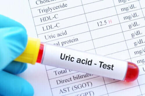Wat zijn de gevolgen van een hoog urinezuurgehalte?