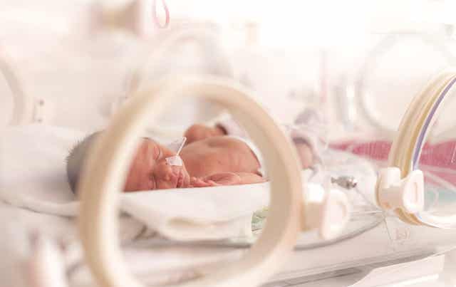 Baby in de couveuse door vroeggeboorte