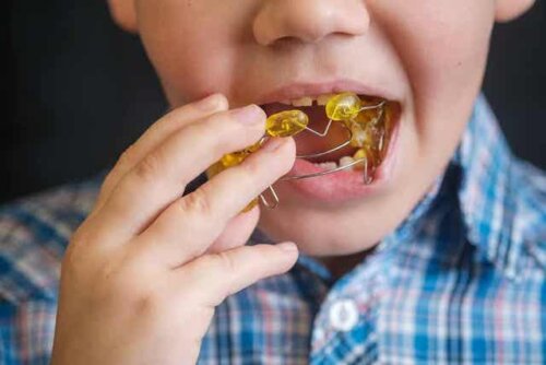 Een kind dat een orthodontisch apparaat in zijn mond stopt