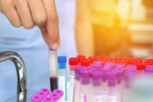 Een laborant met een aantal buisjes bloed