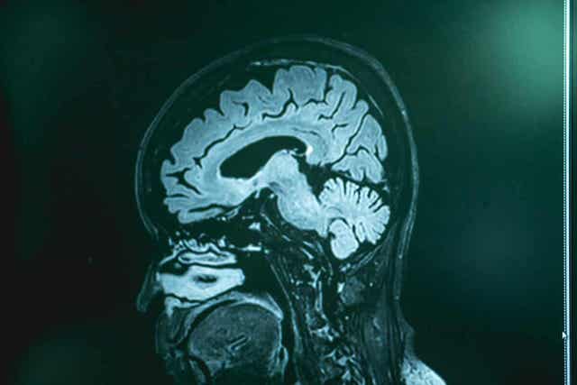 Infectie met Naegleria fowleri