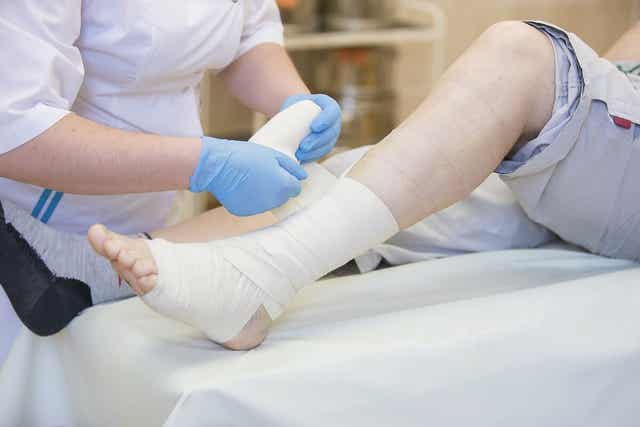 Gipsverband