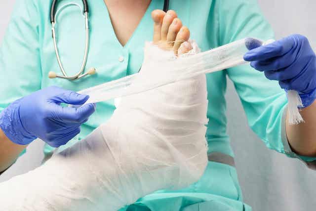 Verpleger brengt gips aan