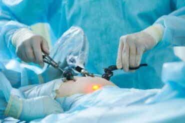 Wat is een laparoscopie?