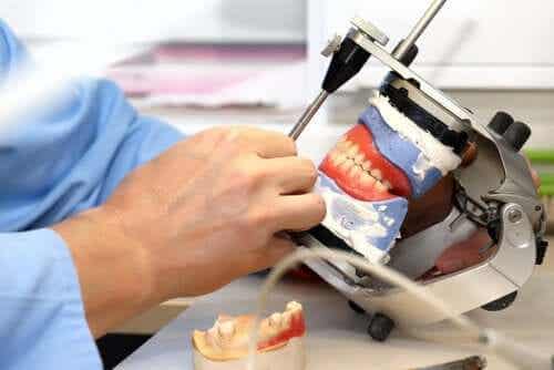 Alles over tandheelkundige implantaten