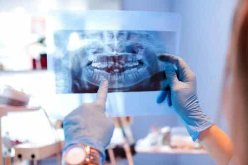 De tandarts bekijkt eerst wat voor soort implantaat er nodig is