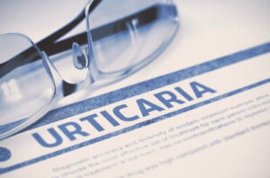 Koude urticaria: risicofactoren en preventie