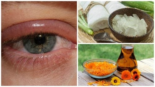 Bestrijd ooginfecties met een van deze 9 remedies