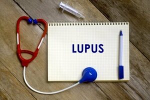 Wat zijn de risicofactoren voor lupus?