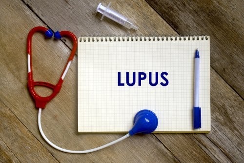 Wat zijn de risicofactoren voor lupus?