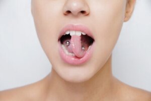 Mondpiercings kunnen gevolgen hebben voor de mondgezondheid