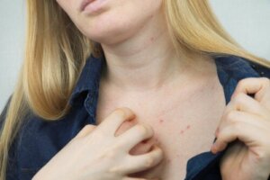 Wat zijn de meestvoorkomende bijwerkingen van cosmetica?