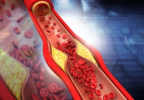 Tips om het HDL-cholesterolgehalte te verhogen