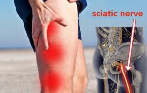 Medicatie tegen pijn aan de heupzenuw