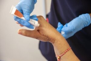 De meestgebruikte soorten helende crèmes en zalven