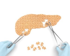 Pancreascysten: oorzaken, symptomen en behandeling