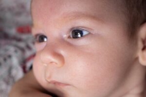 Aniridie of afwezigheid van de iris: waarom komt het voor?