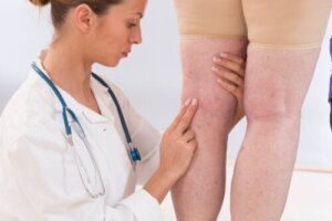 11 symptomen van een slechte bloedsomloop in benen en voeten